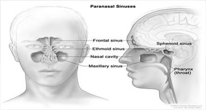 Acute Rhinosinusitis Syndrome (ARS): Defining the terms Inflammation of the mucosal lining of nasal passage and paranasal sinuses lasting up to 4 weeks, caused by allergens, environmental irritants,