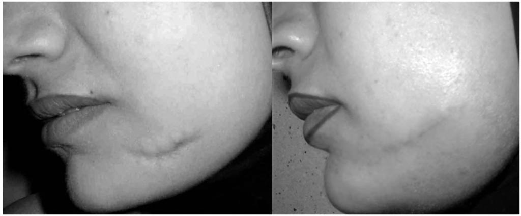 left, and after surgery to the right. Fig. (5): Case No.