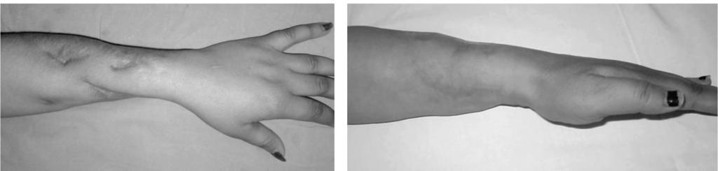 surgery to the left, and after surgery to the right. Fig. (7): Case No.