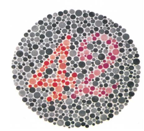 To distinguish between red color blindness and green color blindness, you use the chart below: Normal people will see 42 People with green will see 4 People with red will see 2.