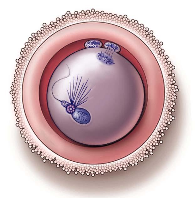 Fertilization Failures: potential etiologies (sperm-borne defects) Lack of oocyte activation