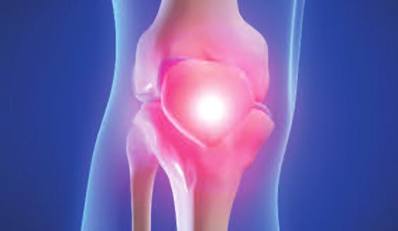 Are You Living with Knee Pain?