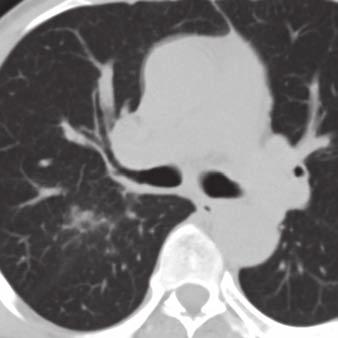 8 70-year-old woman with systemic disease.