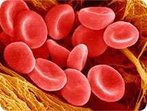 Anaemia Low red blood cells Two out of three patients will have anaemia at some point.