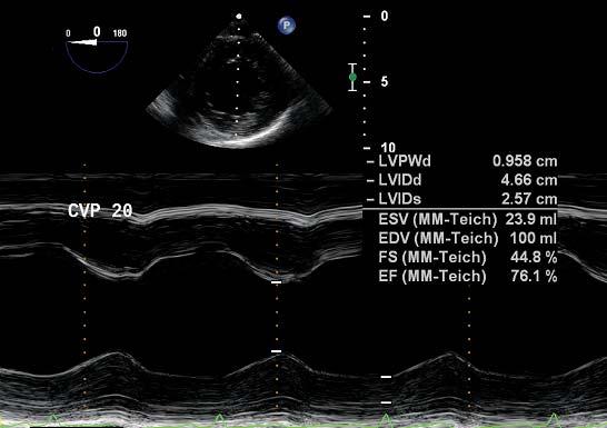 Basic Physics of Ultrasound in Transesophageal Echocardiography travel back to the transducer is measured and is used to calculate the depth of the tissue interface causing the echo.