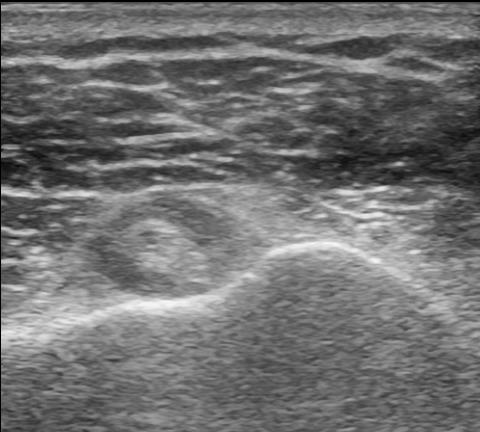 2. For the anterior shoulder images shown, which of the following is the most likely
