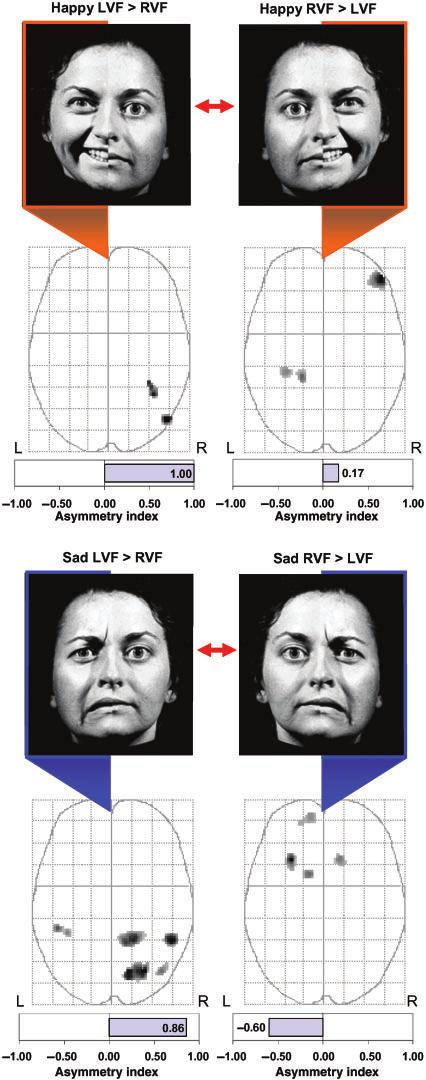 Right-hemisphere and valence hypotheses SCAN (2007) 245 Table 2 Significant clusters of activation during direct comparison of left vs right-lateralized presentations (paired t-test) for Happy and