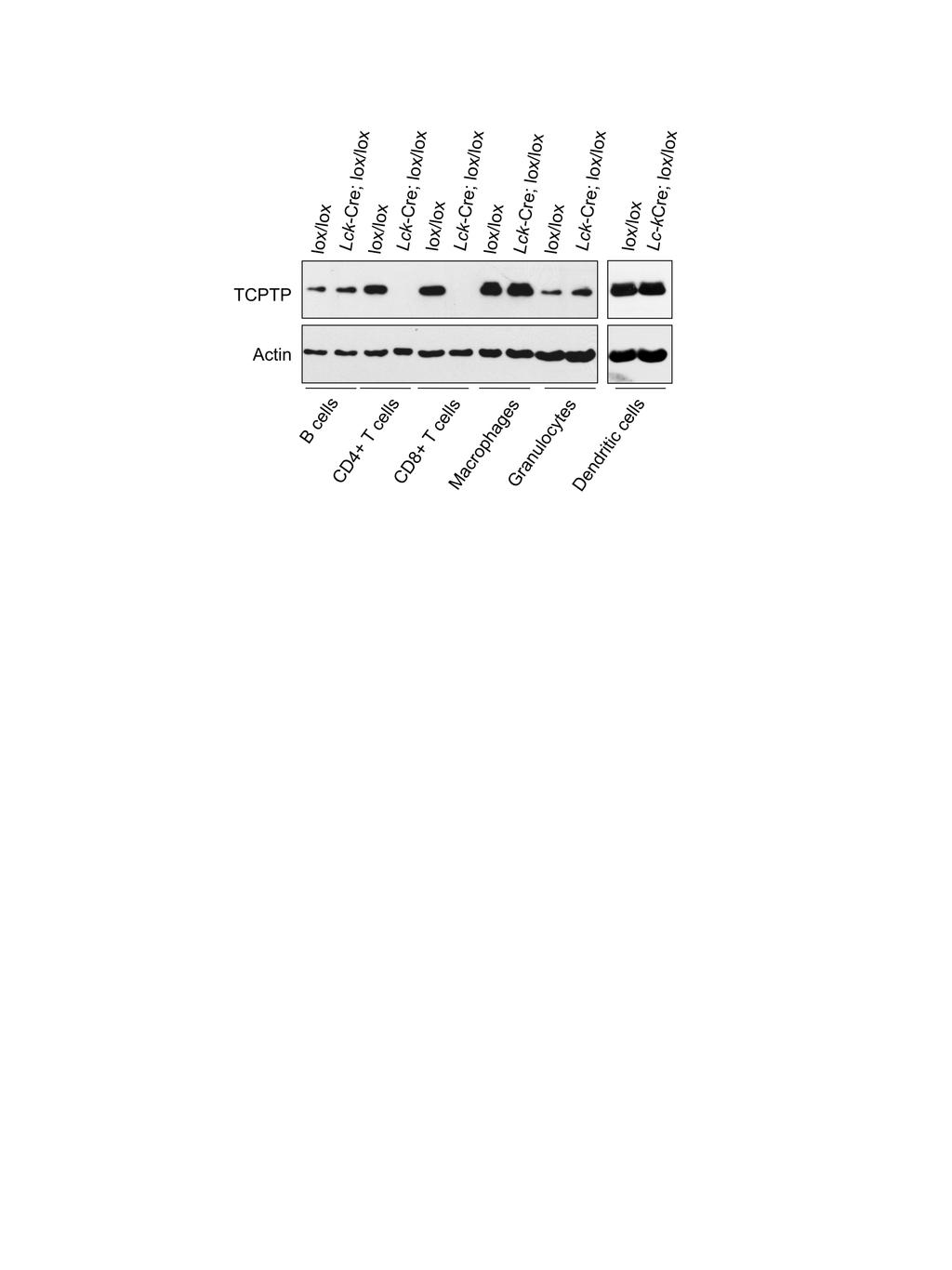 Supplementary Figure 15. TCPTP expression in aged mice.