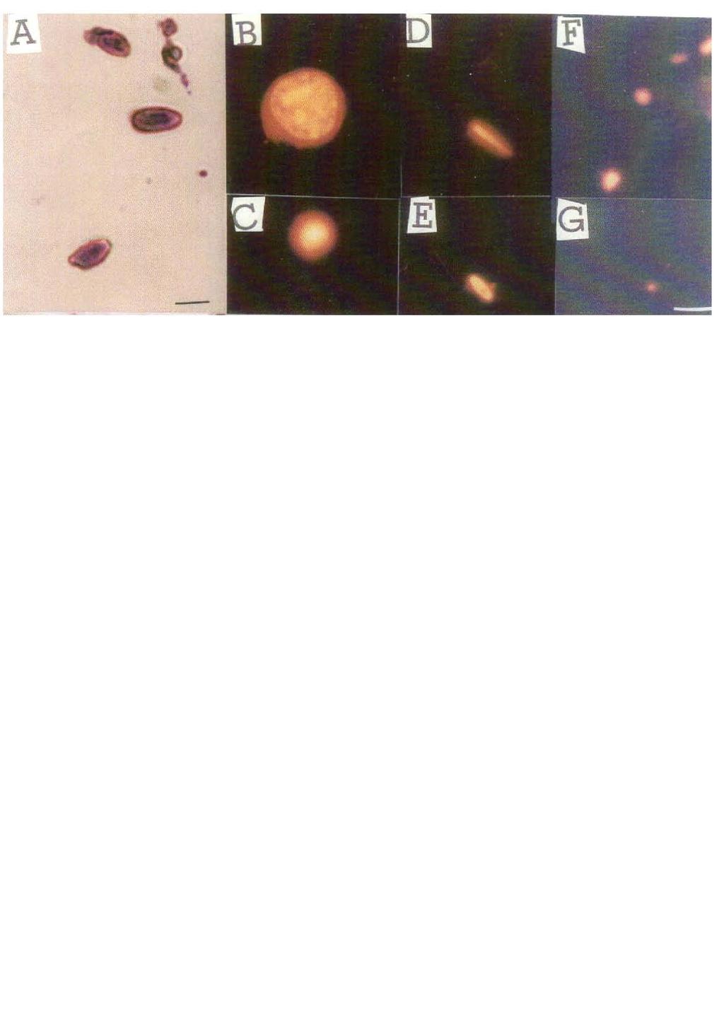 A: After 15 minutes of the addition, Sph- DNA aggregates (arrow) were observed on the L-M cells. After 3 hours of the addition, the destruction of the cells (arrow) were observed (B).