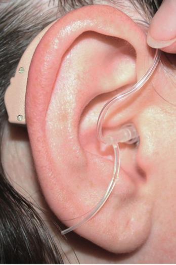 The purpose is to hold the tube more securely in the ear canal.