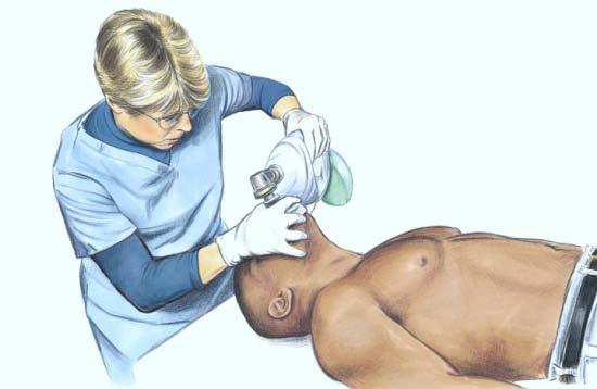 Figure 3A. Figure 3B. Figure 3. A, E-C clamp technique of holding mask while lifting the jaw. Position yourself at the patient s head.