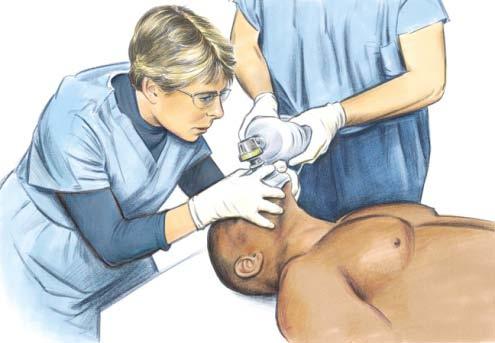 The rescuer at the patient s head tilts the patient s head and seals the mask against the patient s face with the thumb and first finger of each hand creating a C to provide a complete seal around