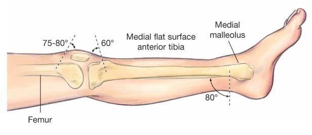 3 Insert the needle so that it is perpendicular to the tibia.
