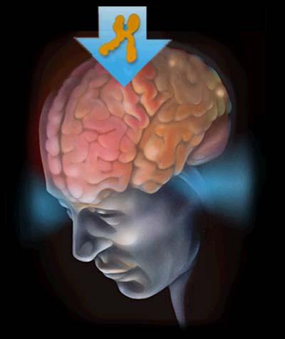 MIGRAINE PATHOPHYSIOLOGY Neuroanatomical correlates of the migraine attack Vulnerability to migraine Triggering migraine Migraine aura Migraine pain The frequency with which migraine attacks occur