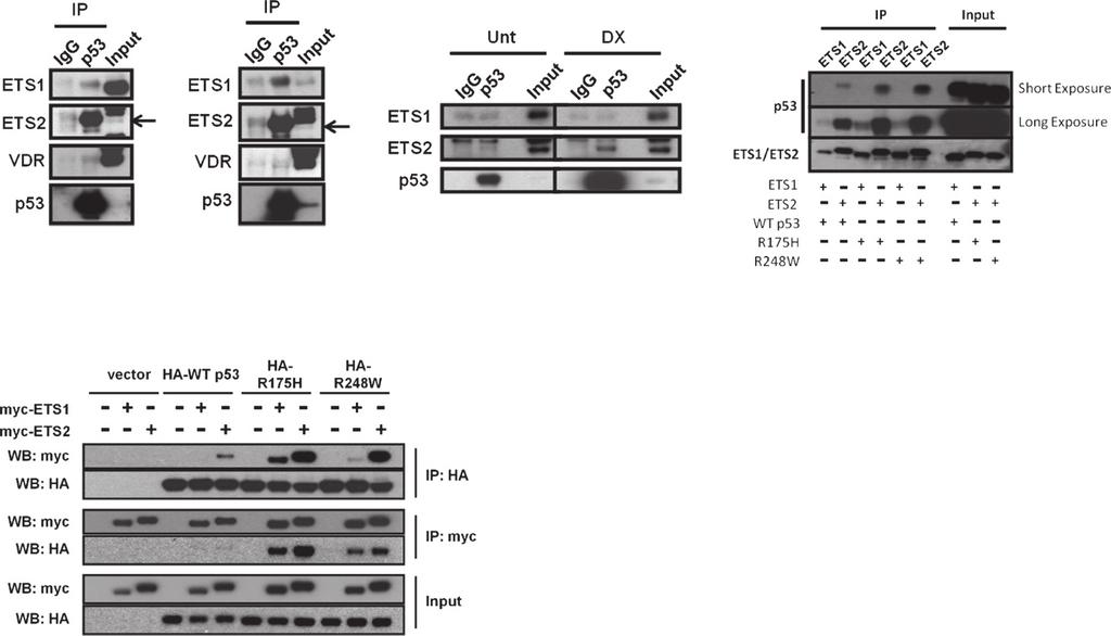 Do et al. Figure 3. Interaction study of mtp53 and ETS proteins. Endogenous mtp53 can coimmunoprecipitate with ETS1 and ETS2 in MDAH087 (A) or MIA PaCa-2 (B) cell lysates.