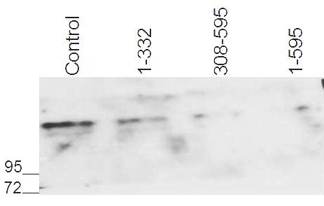 Immunoblotting of the cell extracts was performed with anti-phospho MLK3 (Thr 277/Ser 281) antibody and anti-mlk3 antibody.