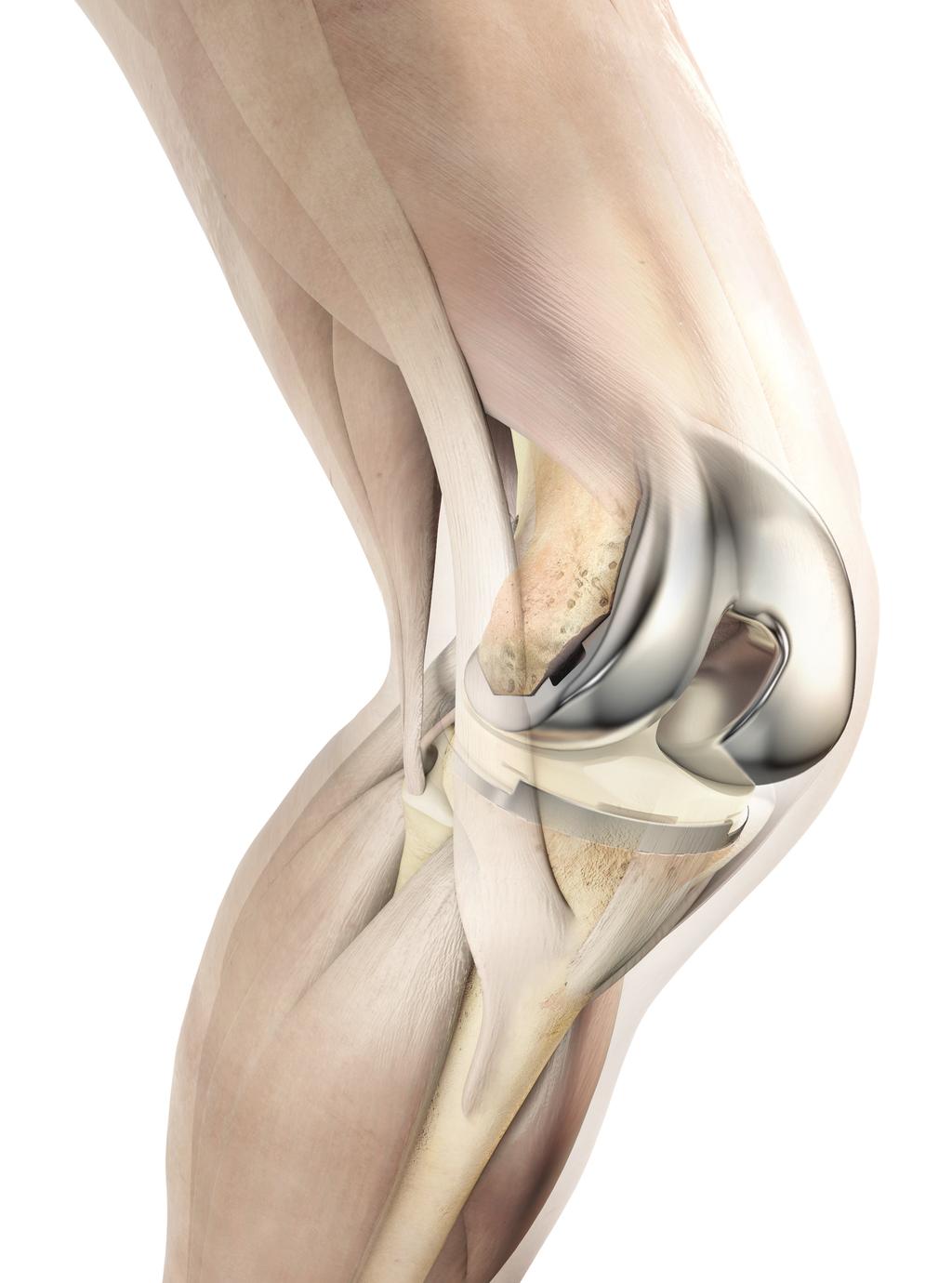 What makes the development of the ATTUNE Knee System different?