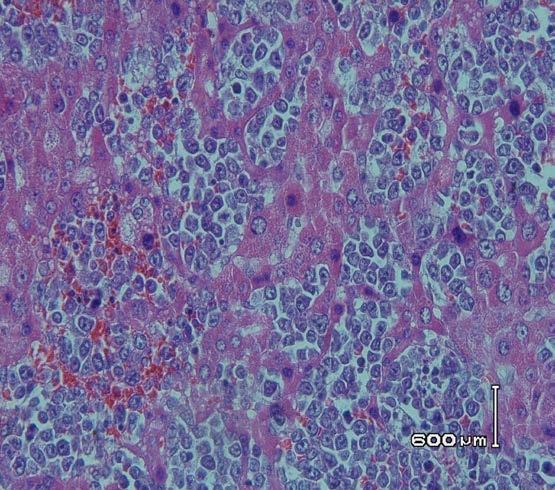 Lymphoblastic cells are pointed by black arrow. Magnification x 400. Figure 7. AgNO 3 stained liver tissues of control and experimental group. Rats were divided into 4 groups, (A) 0.