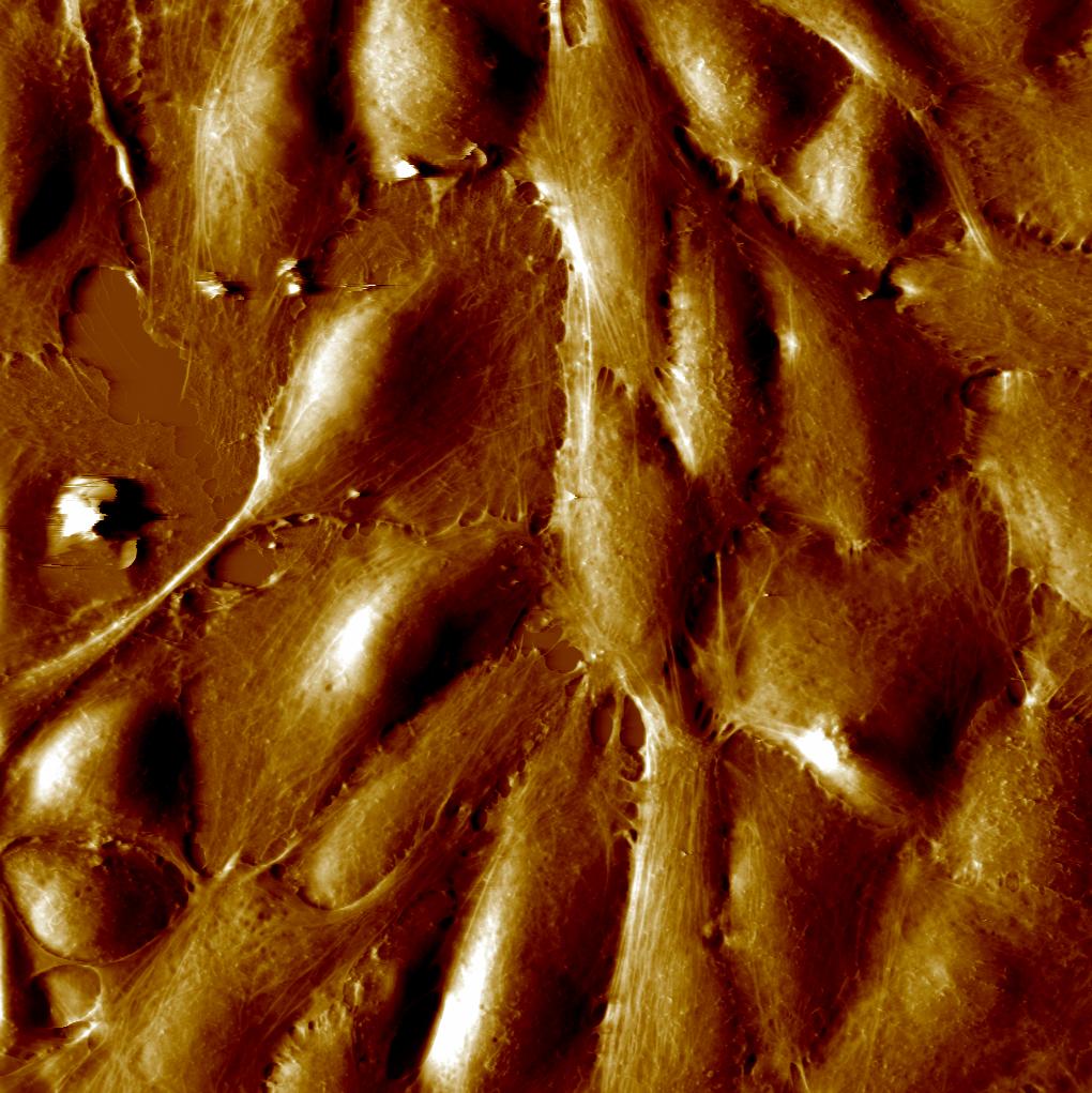 Endothelium (Felix) imaged in fluid Image size: 180 x 180 µm Image resolution: