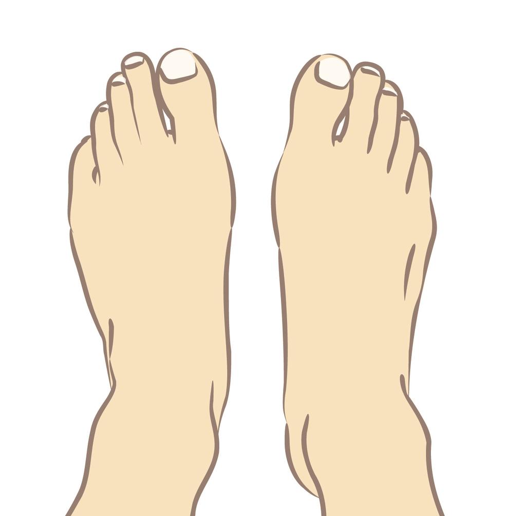 How To Achieve Happy Feet Many people with diabetes have problems with their feet.