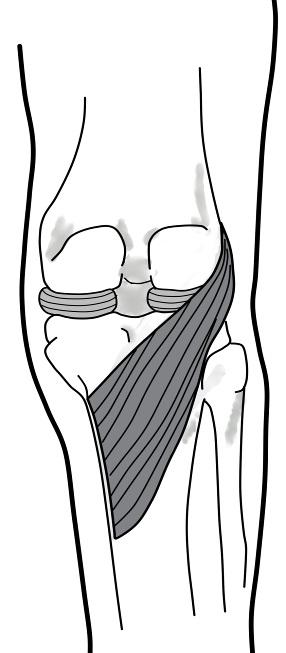 Knee Fix (from Quick Self Fixes Program) KNOW YOUR BODY This fix helps prevent knee and ankle instability and pain.