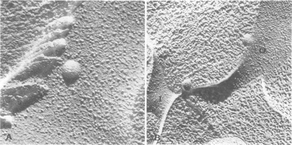 This surface particles about 75 nm in diameter are seen on faces away from the interior of the cell (Fig. 4b) this interior-membrane surface.