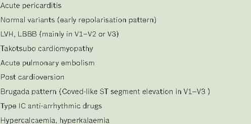 Table. Causes of nonischaemic ST segment elevation on ECG.