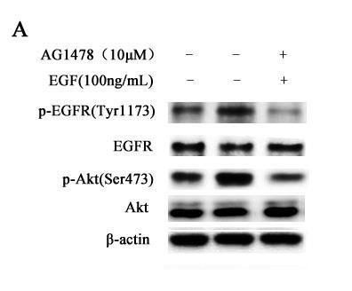 2. AG1478 inhibit EGF-induced U251 cells Proliferation We performed the cell proliferation assay in order to explore the effect of EGF upregulation and downregulation on glioma cell proliferation in