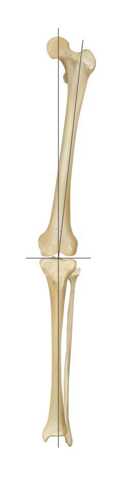 On the x-ray, draw a line through the center of each femoral canal to the center of the knee joint (anatomic axis).
