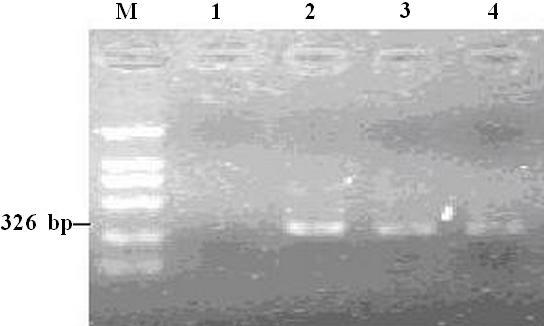 Relationship of P16 gene CpG methylation and HPV16 infection 7431 observation, 5 ml PCR product was applied to 2% agarose gel electrophoresis, and then photographs were acquired under an ultraviolet