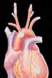 Effects of Neprilysin Inhibition in Heart Failure Endogenous vasoactive peptides
