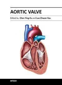 Aortic Valve Edited by Prof.
