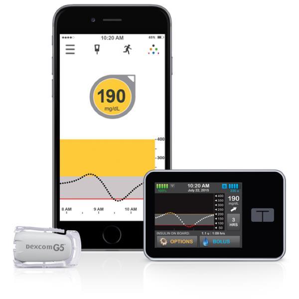 Tandem PLGS System - Will use CGM data DEXCOM G5 to determine possible hypoglycemia and