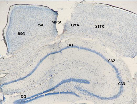 Figure 9. Histological verifications confirmed tetrode location within the intermediate dorsal CA1 of hippocampus. Representative histology image of the mouse hippocampus after electrode implantation.