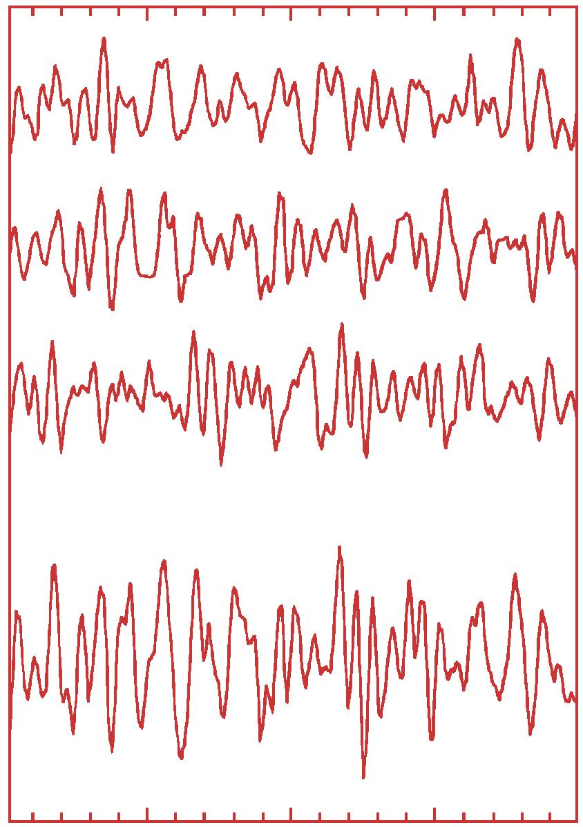 Improvement of signal/noise relation by 3-fold summation: Emission