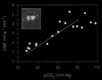 Arterial Spin Labelling CBF (ml g -1 min -1 ) pco2 (mmhg) Williams et