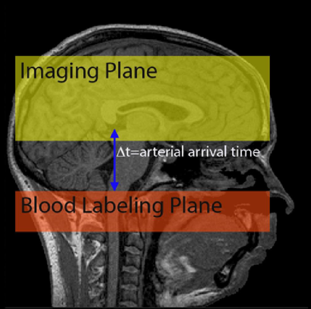 water at the neck (below imaging plane) Labeled blood moves downstream