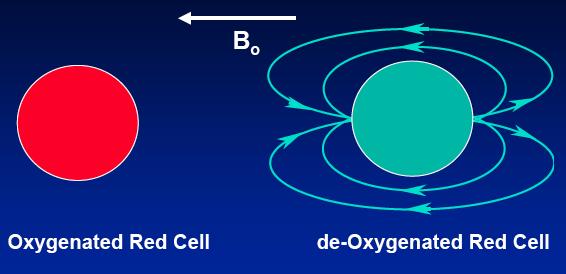 Field homogeneity & oxygenation state Red blood cell 6 µm diameter, 1 2 µm