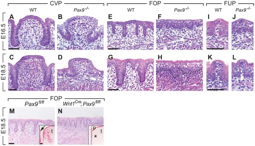 Figure 2. Arrest of CVP and FOP development in Pax9-deficient mouse embryos. (A,C) In wild type (WT) embryos, the invaginating CVP epithelium forms deep trenches.