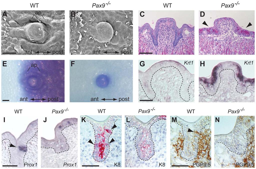 Figure 4. Differentiation defects and lack of proneural induction in the Pax9-deficient CVP trench epithelium. (A N) Analyses of mouse embryos at E18.5.