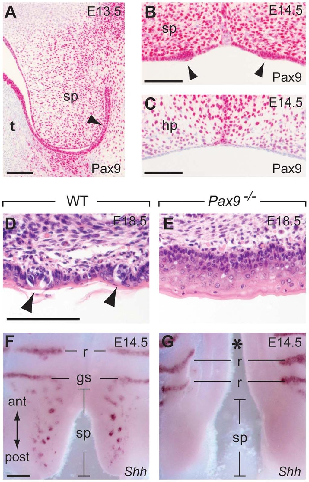 Figure 7. Pax9 is essential for taste placode formation in the soft palate. (A C) Pax9 immunostaining of the secondary palate. (A) At E13.
