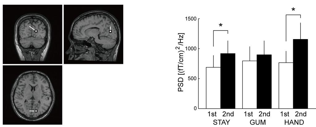 Figure 2. Representative result of PSD in five brain domains (F: frontal, P: parietal, L: left temporal, R: right temporal, O: occipital) during WM maintenance (subject D).