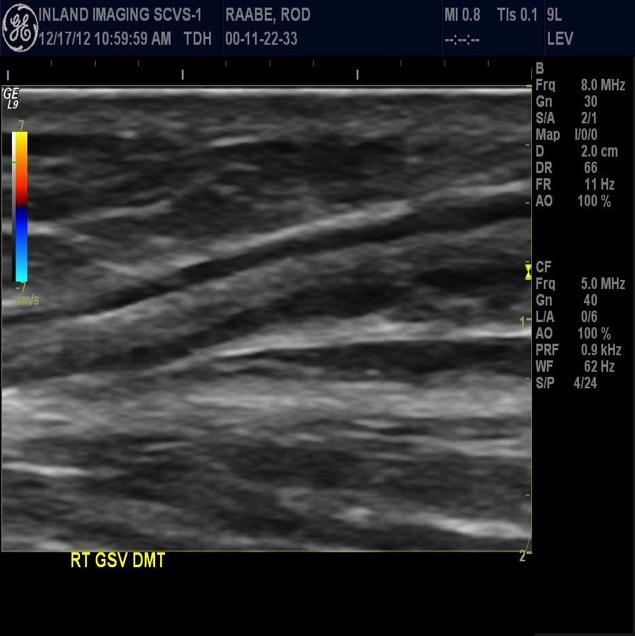 Ultrasound Images 8 weeks post