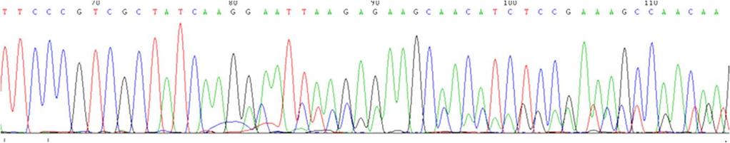 Determination of EGFR mutations For analysing the EGFR mutation status, the extracted DNA was subjected to conventional PCR for amplification of relevant portions of exons 18, 19 and 21 of the EGFR