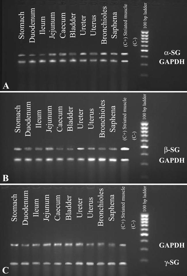 840 Anastasi, Cutroneo, Sidoti, Rinaldi, Bruschetta, Rizzo, D Angelo, Tarone, Amato, Favaloro Figure 8 2% Agarose gel electropherogram of RT-PCR products amplified using human RNA as template, primer