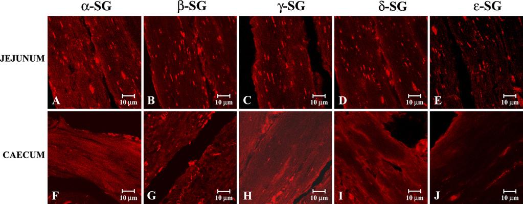 In the stomach (A E), duodenum (F J), and ileum (K O), a-sarcoglycan staining appeared reduced but clearly detectable; other tested protein stainings were clearly detectable.