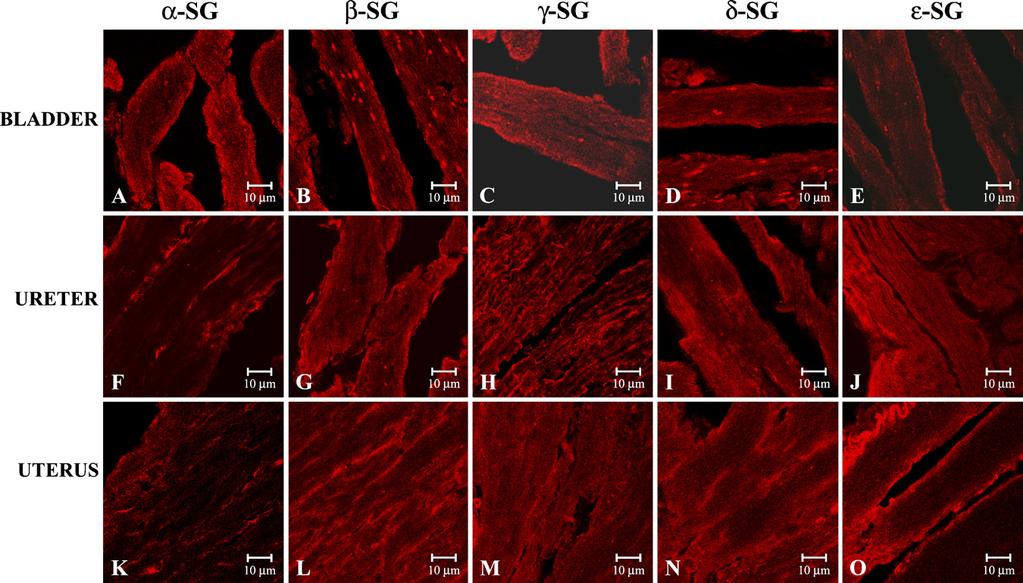 836 Anastasi, Cutroneo, Sidoti, Rinaldi, Bruschetta, Rizzo, D Angelo, Tarone, Amato, Favaloro data revealed a normal staining pattern of a-, b-, g-, and y-sarcoglycans, clearly visible in jejunum
