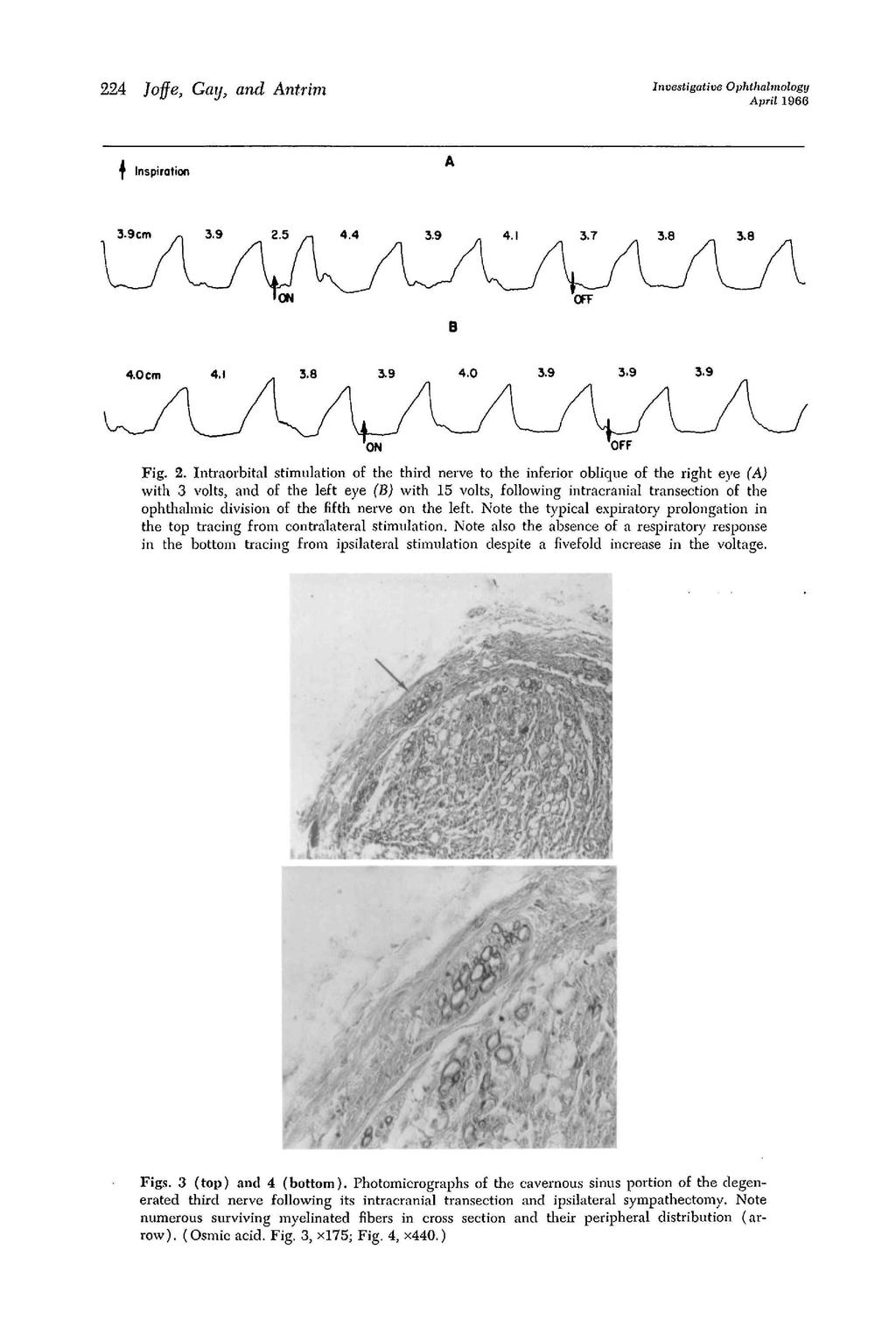 224 loffe, Gay, and Antrim Investigative Ophthalmology April 1966 Inspiration 3.9cm n 3.9 2.