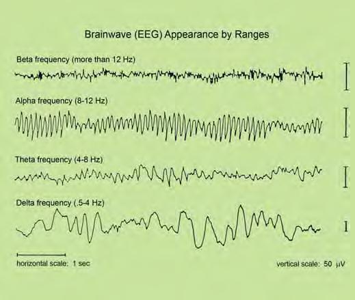 Brainwave Signatures Arousal States Beta excited