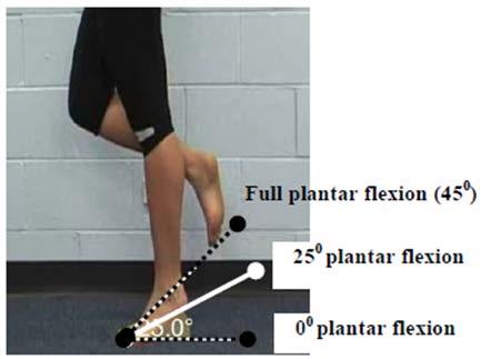 Primary Criterion #6 Ankle plantar flexion loss of 3 muscle grade points (muscle grade of two).